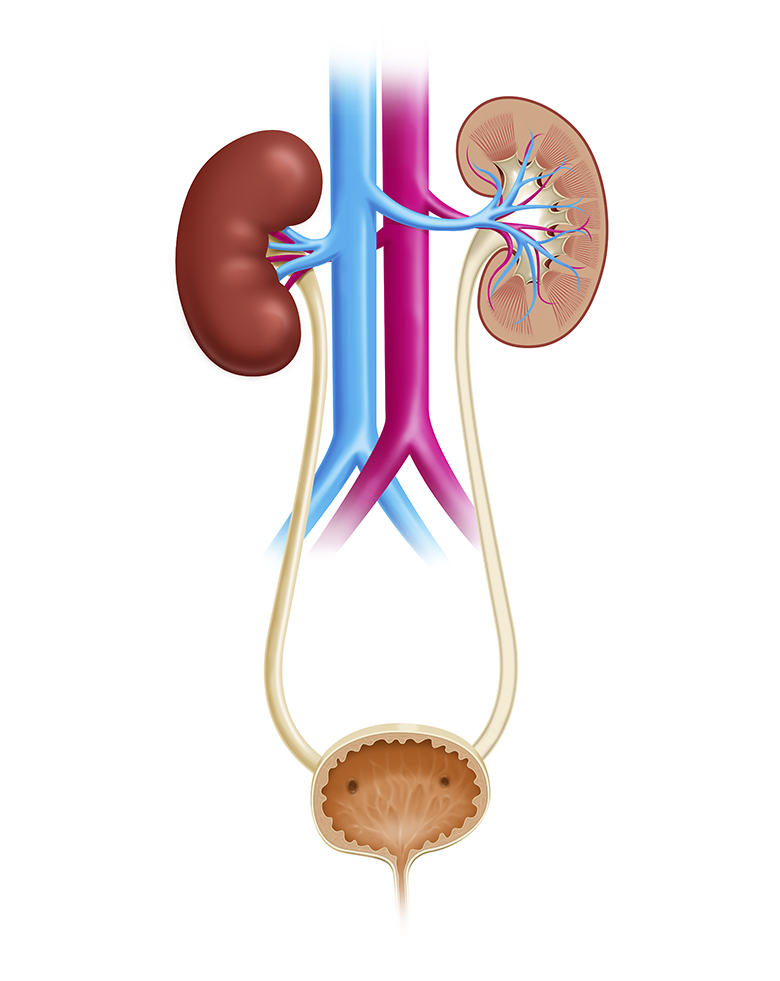 urologista-dr-celso-calculo-ureterais