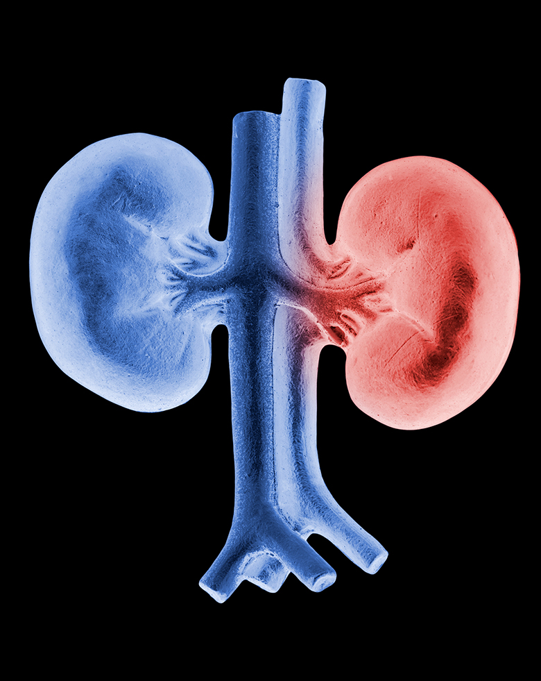 urologista-dr-celso-carcinoma-renal